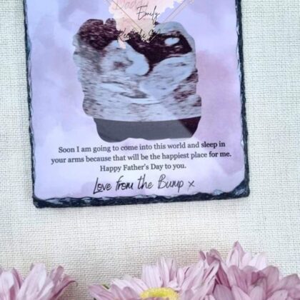 Zdjęcie na kamieniu kwadrat USG